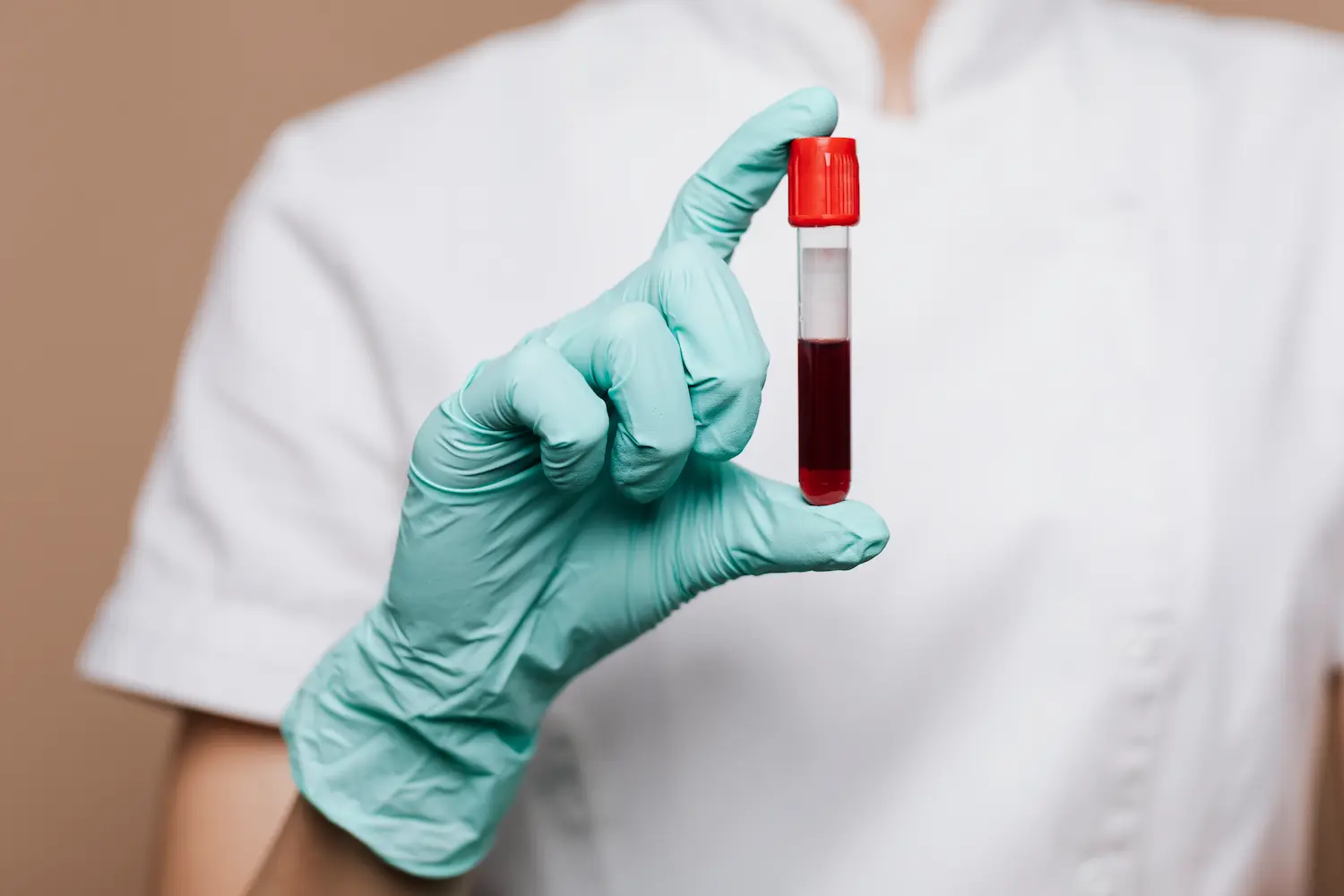 inyecciones de plasma rico en plaquetas (PRP) Barcelona